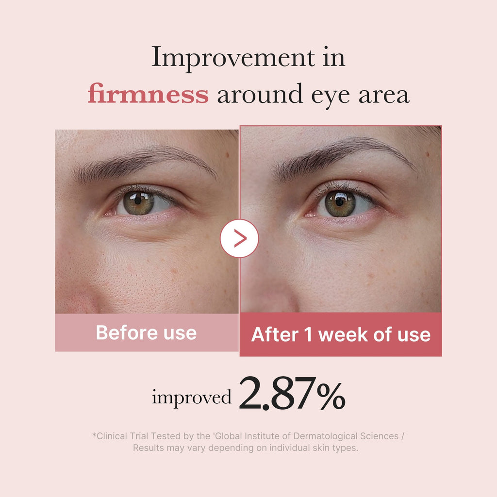 [Exclusive Deal] Amazon’s #1 Beauty Brand |  PDRN Pink Peptide Eye Cream