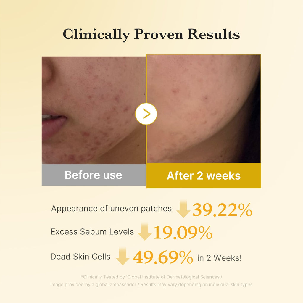 [Subscr.] Kojic Acid Turmeric Toner Pad